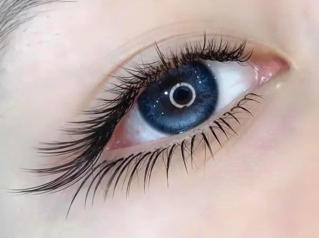 Mi
